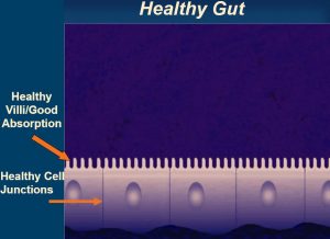 5R Protocol, Gut healing, Leaky Gut